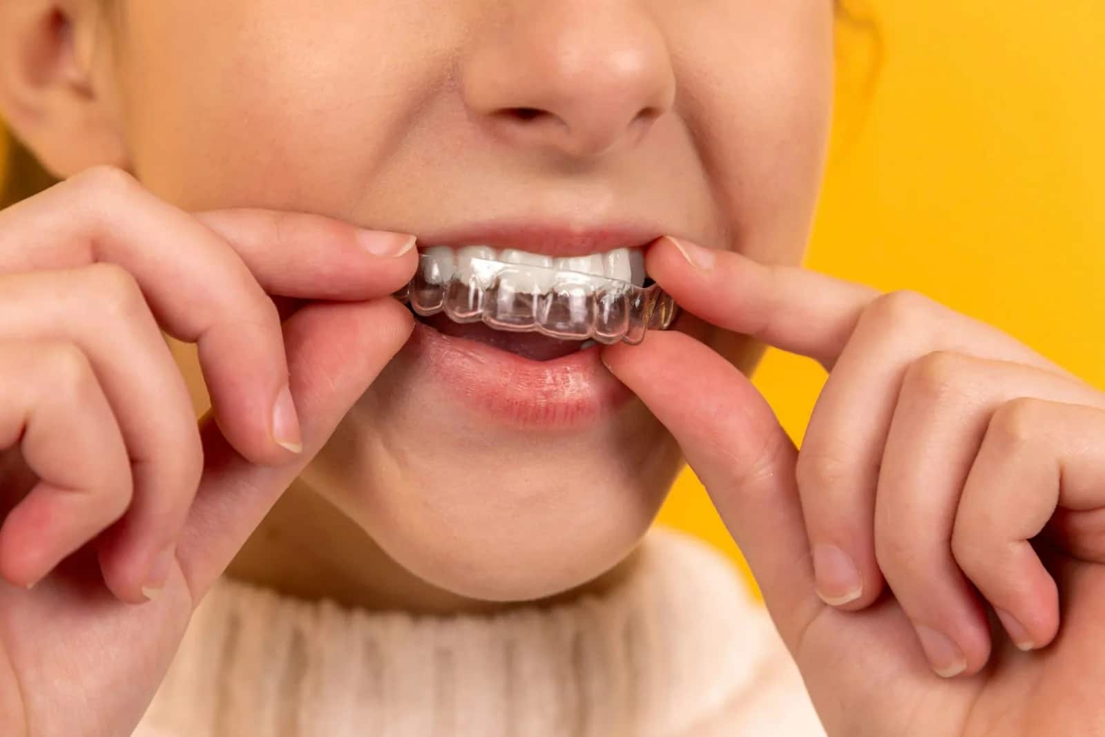 Clínica Dental Sonríe: Opciones de ortodoncia valoradas de acuerdo con las necesidades de cada paciente.